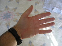 Hand